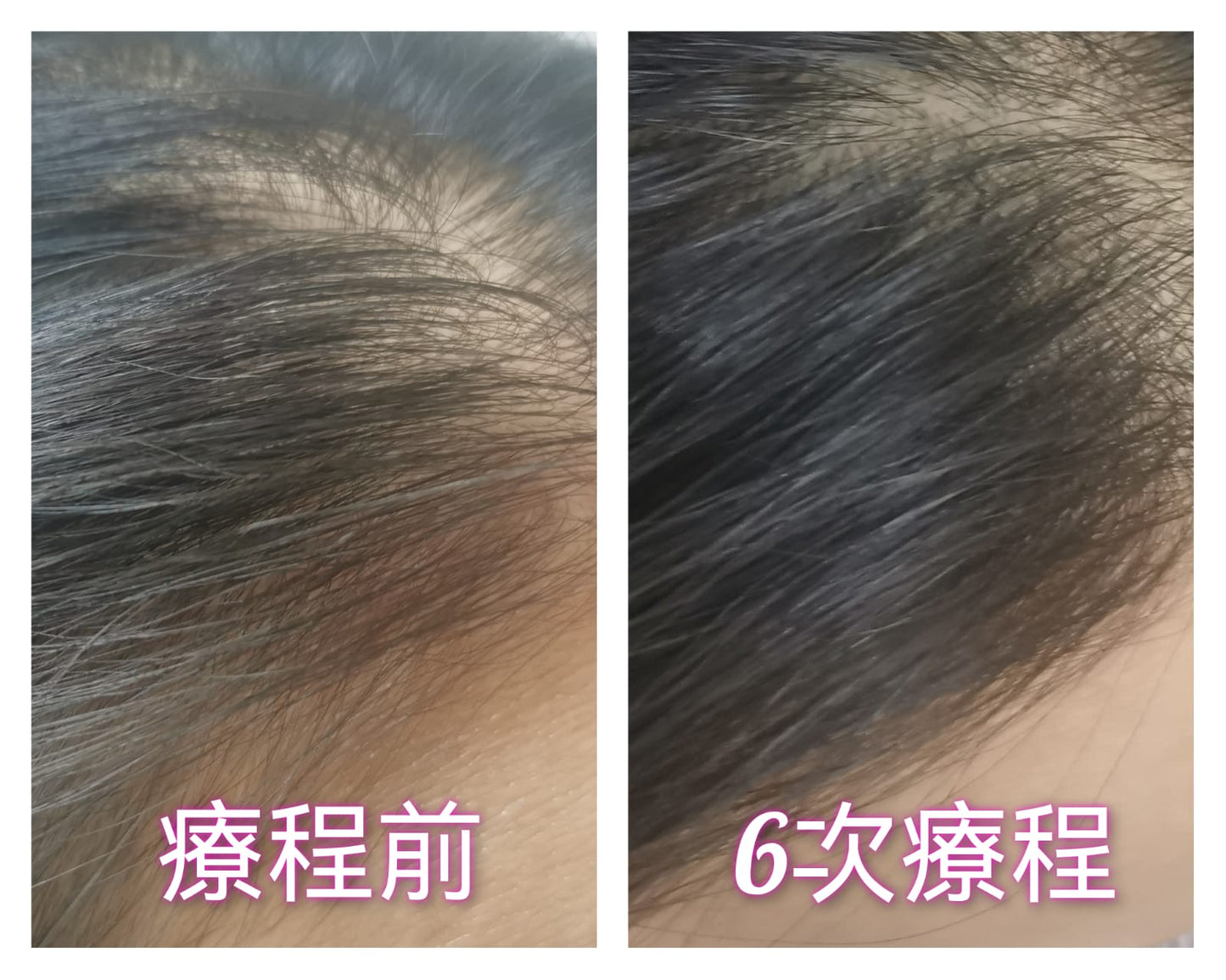 頭髮療程Hair Treatment